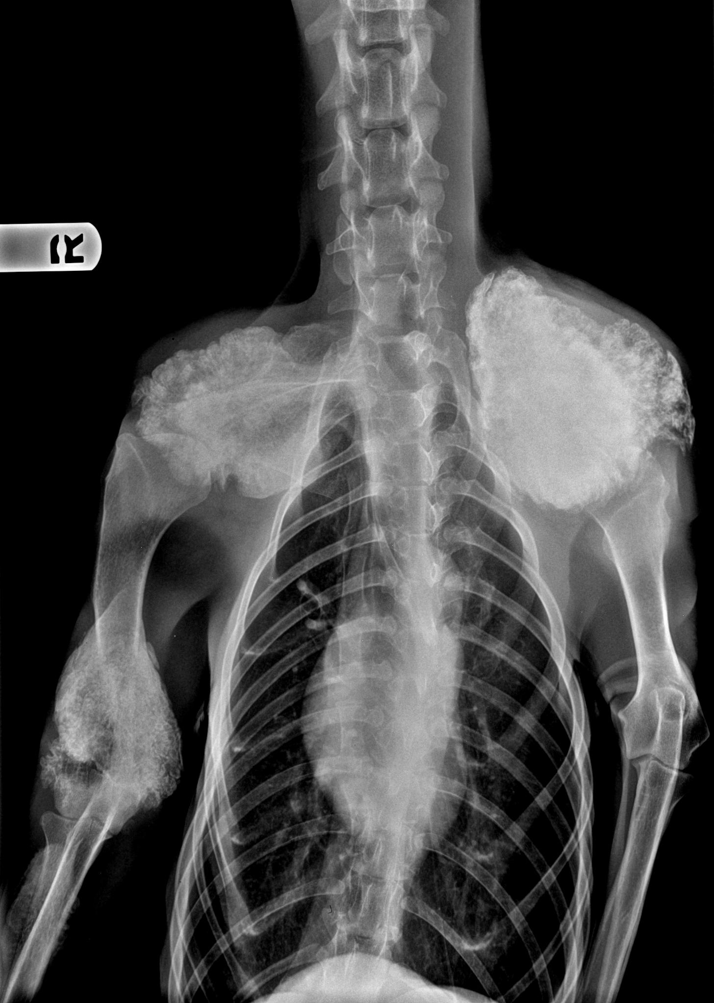 bone-lesions-on-xray-m-a-i-n-medical-animals-in-need-dog-rescue